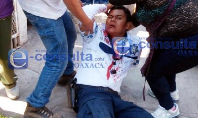 policia_herido_por_taxista_en_oaxaca_copia
